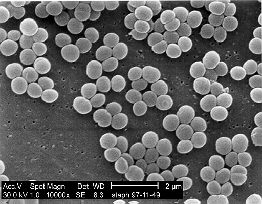 1280px-Staphylococcus_aureus_01