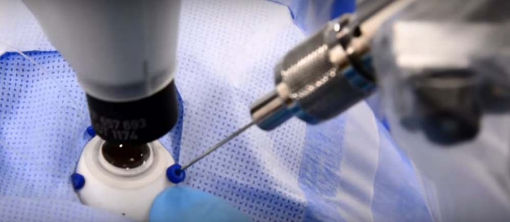 یک ربات جراح با شیوه‌ای نوین، به پزشکان در جراحی چشم کمک کرد