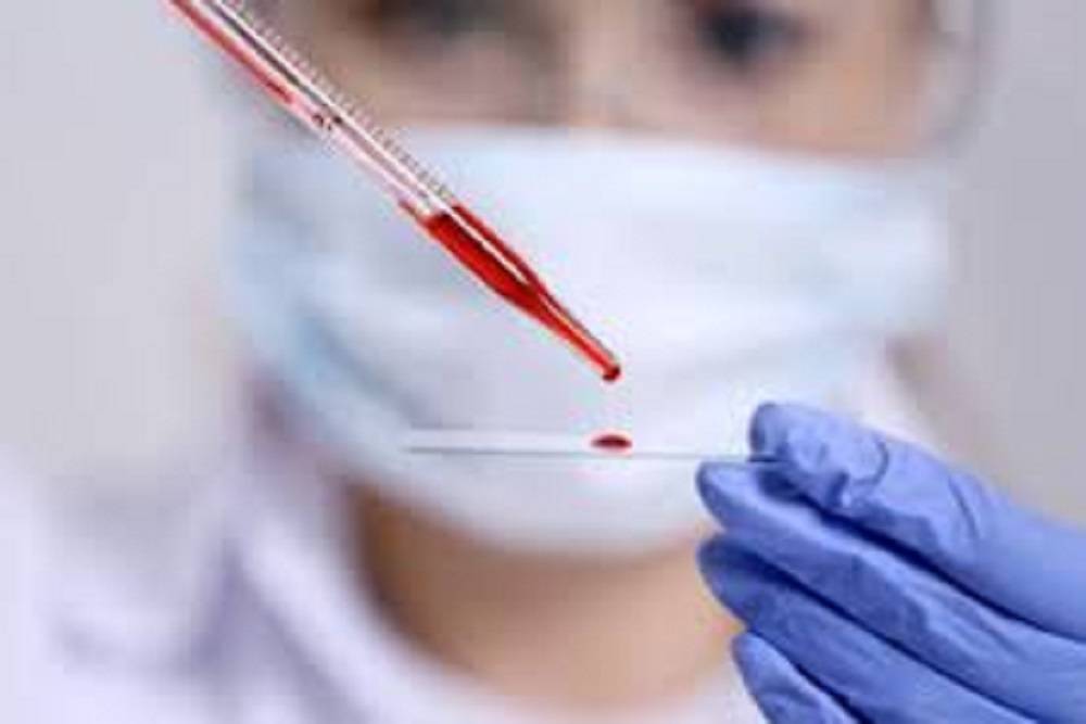 bloodtest گروه‌های خونی مختلف چه تفاوتی با هم دارند؟  