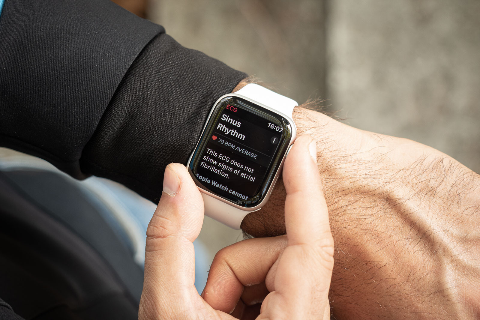 نسل بعدی ساعت‌های هوشمند اپل واچ قادر به تشخیص حرکات ماهیچه کاربر خواهند بود!
