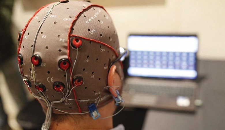 Studies have shown that electrical brain stimulation improves memory in 1 قطب آی تی