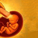 سامانه سقط جنین